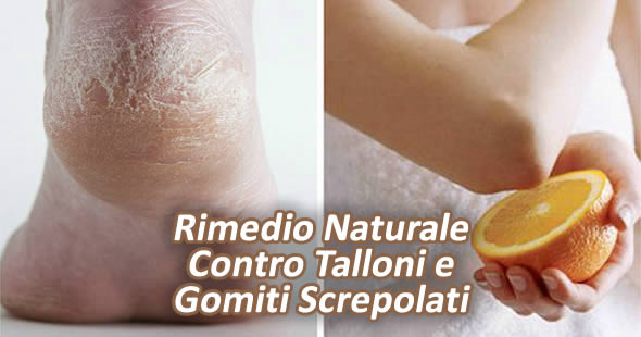 Rimedio Naturale Contro Talloni E Gomiti Screpolati