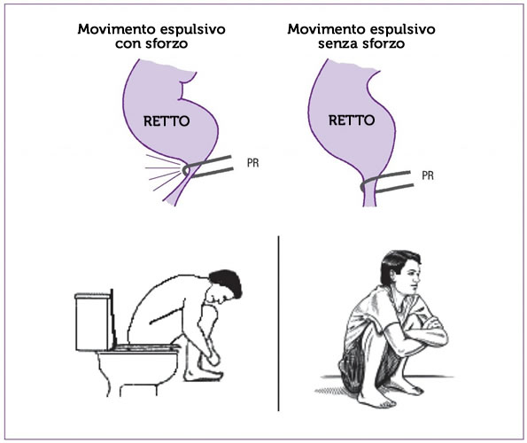 come defecare correttamente