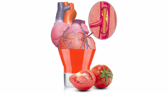 rimedio per sbloccare arterie intasate