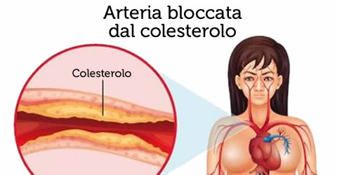 eliminare colesterolo da vasi sanguigni