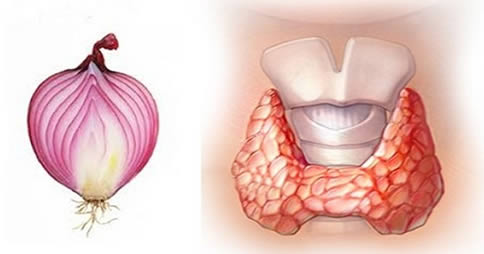 cipolla tiroide