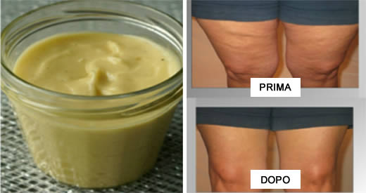 crema fai da te cellulite