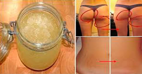 crema smagliature cellulite