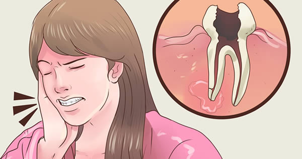 rimedio naturale mal di denti