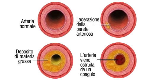 cosa devi sapere sui trigliceridi