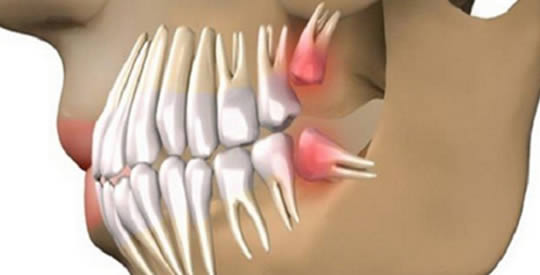 nuova ricerca ricrescere denti