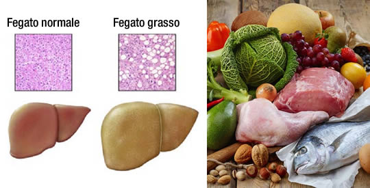 Fegato Grasso Cosa Fare E Cosa Mangiare Per Curarlo