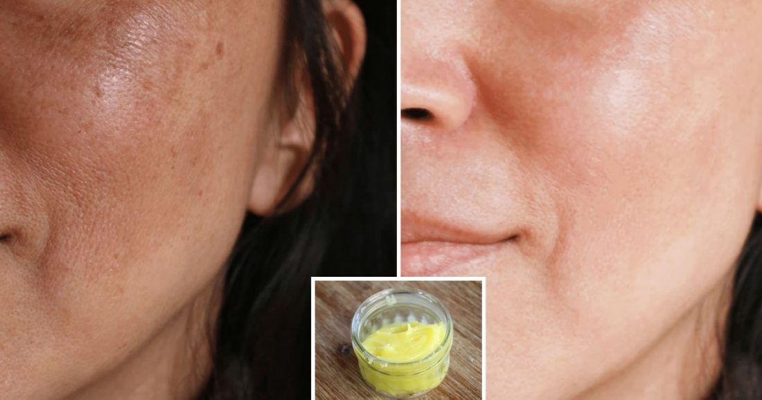 Olio D Oliva Sulla Pelle Del Viso Olio d'oliva, limone e vitamina E: gli ingredienti perfetti per avere