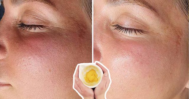 pulizia del viso per punti neri fai da te